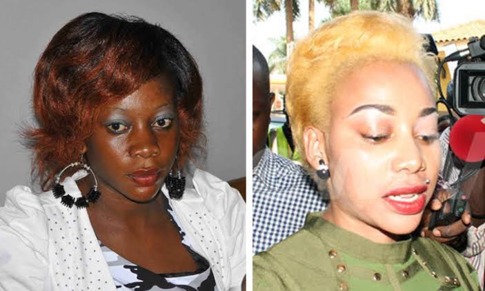 vera sidika bleaching before and after