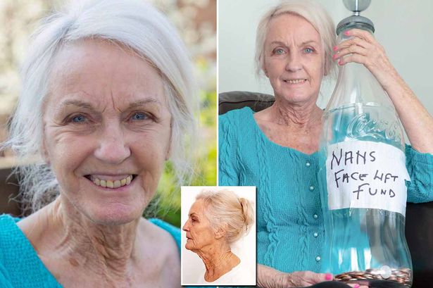 Facelift Great Granny 80 Going Under Knife Again After Saving For Years For First Op Boombuzz