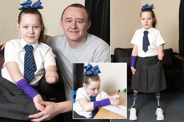 Dad Begs NHS To Give Nine-year-old Triple-amputee Daughter 'bionic Hero ...