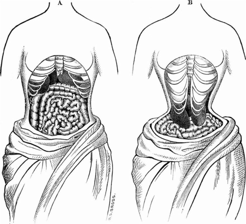 Do waist trainers really help blast belly fat? Here are 7 things you