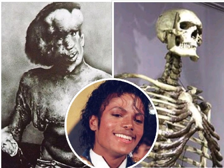 Did Michael Jackson buy the elephant man bone?