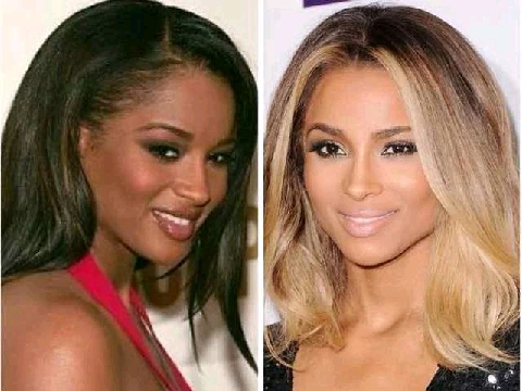 Celebrities Who Bleached Their Skin Before And After Photos