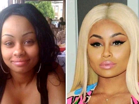 Celebrities Who Bleached Their Skin Before And After Photos