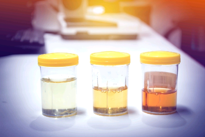 &apos;BioChemistryOfLife: Composition and Properties of Urine 