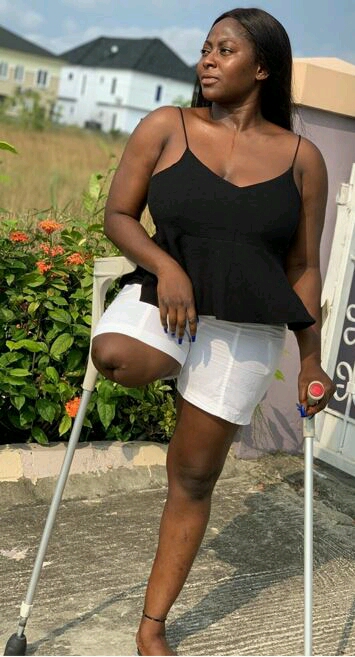 Why Men Fall In Love With Me Despite Losing A Leg - Actress, Doris Akonanya