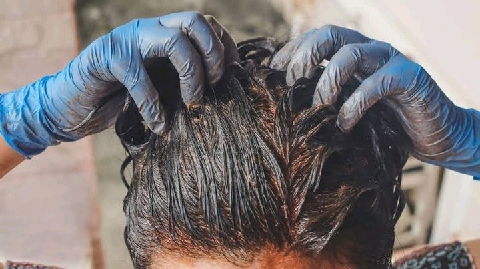 Hair Dyes and Cancer Risk - Types, Chemicals, Side Effects, Precautionary  Methods