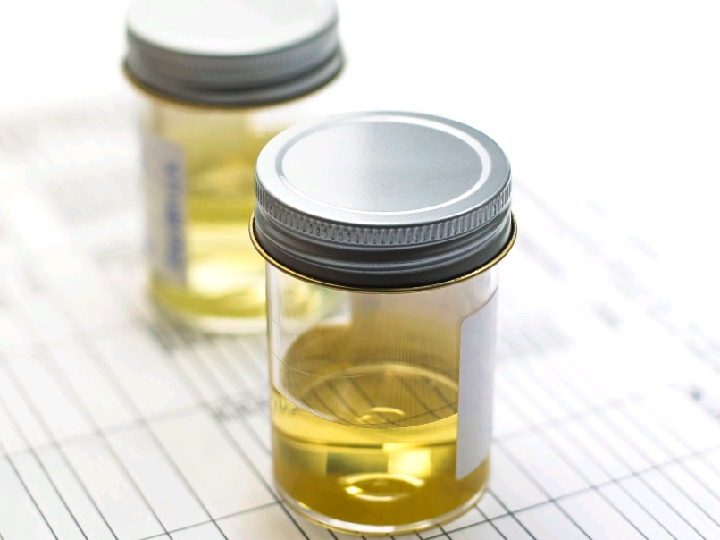 &apos;BioChemistryOfLife: Composition and Properties of Urine 