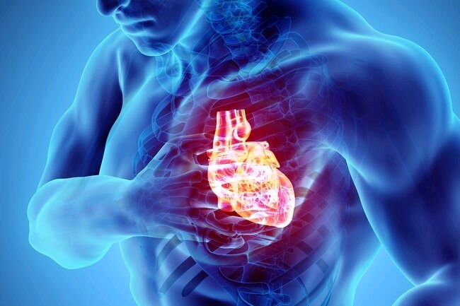 All you need to know about cardiac arrest