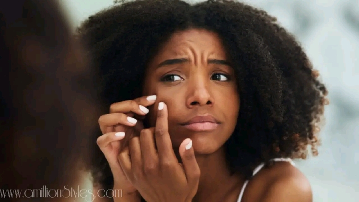 How to Effectively Treat Acne on Dark Skin: 6 Tips and Tricks