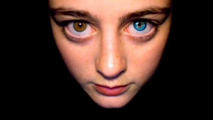 Have You Thought Of This? — Why Do Humans Have Different Eye Colors? 