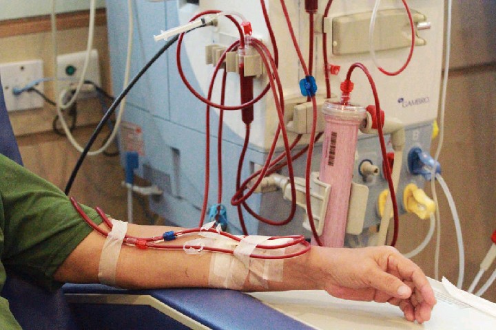&apos;HealthyLifeMatters: Hemodialysis, A Procedure To Good Health 