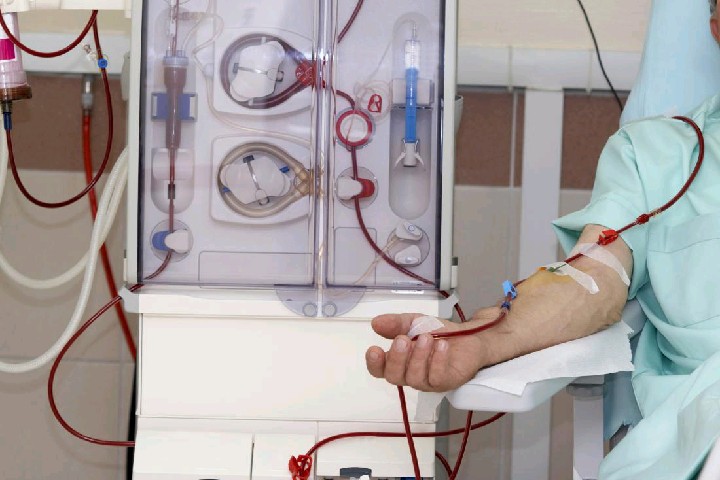 &apos;HealthyLifeMatters: Hemodialysis, A Procedure To Good Health 