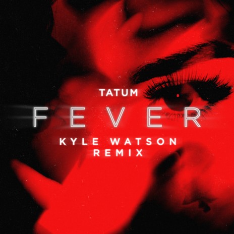 Fever (Kyle Watson Remix) ft. Kyle Watson | Boomplay Music