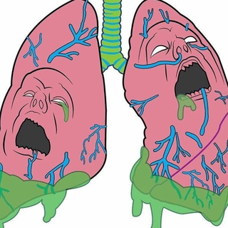 Lungs Collapse