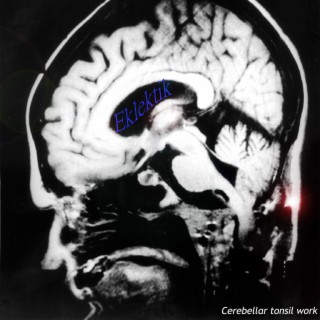 Cerebellar tonsil work