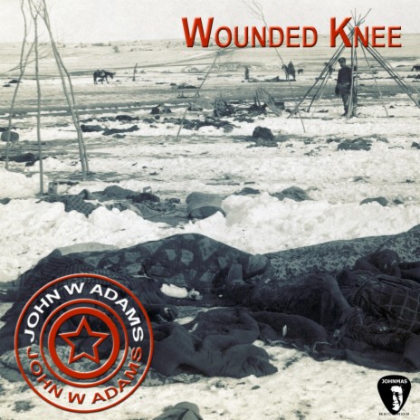 Wounded Knee ((remix)) | Boomplay Music