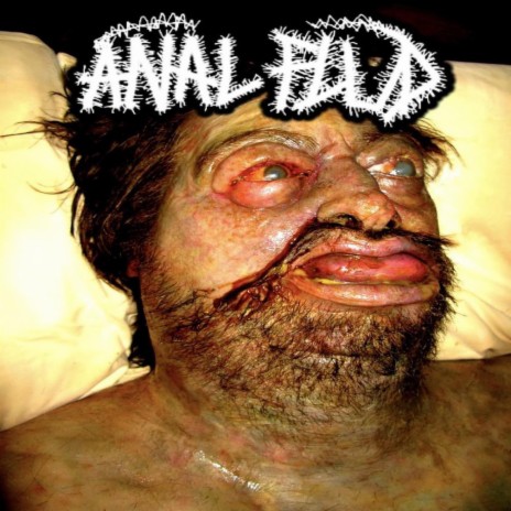 (ANAL FLUD) - ANAL FLUD | Boomplay Music