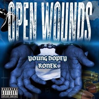 Open Wounds