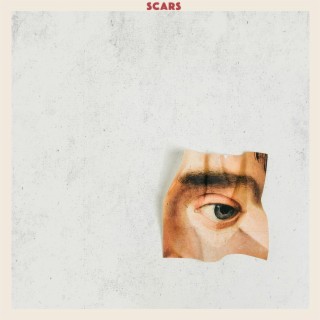 Scars