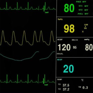 Puls steigt