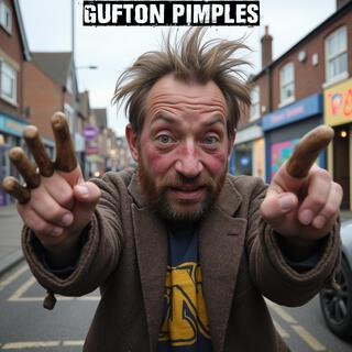 GUFTON PIMPLES