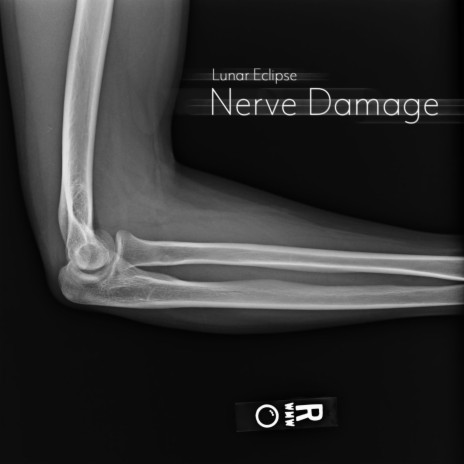 Nerve damage