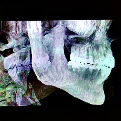 Computed Tomography | Boomplay Music