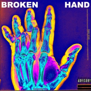 BROKEN HAND