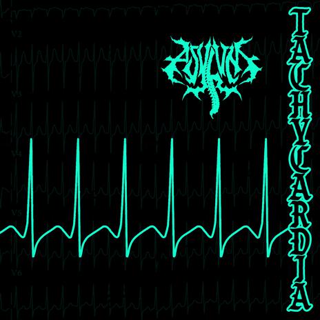 Tachycardia | Boomplay Music