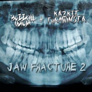 Jaw Fracture 2