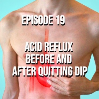 Acid Reflux Before and After Quitting Dip - Episode 19