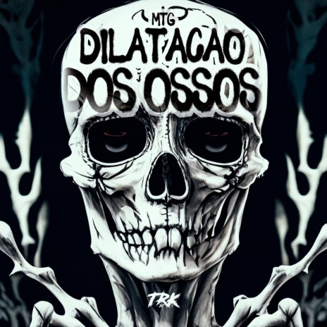 MTG - DILATAÇÃO DOS OSSOS