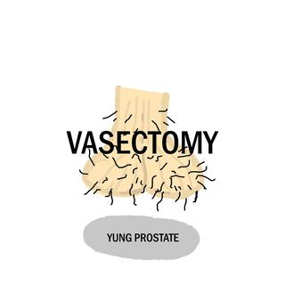 VASECTOMY