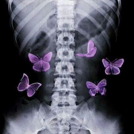 Butterflies Are Warning Signs