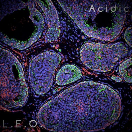 Acidic