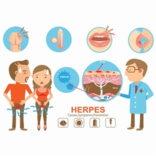 Genital Herpes Stages, Podcast