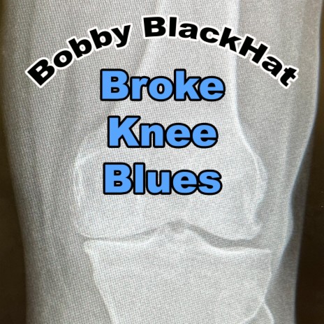 Broke Knee Blues | Boomplay Music