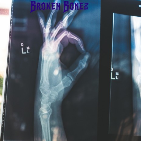 Broken Bonez | Boomplay Music