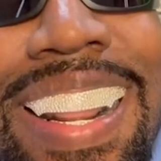 Kanye's Teeth