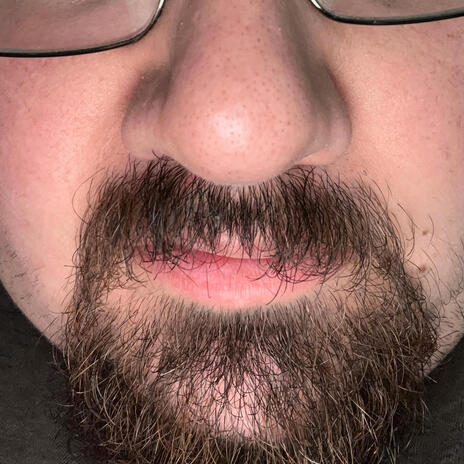 Shitty Fucking Gross Ass Beard