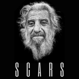 Scars