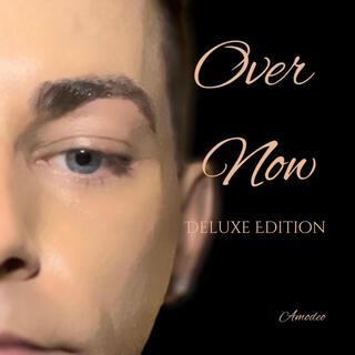 Over Now (Deluxe Edition)