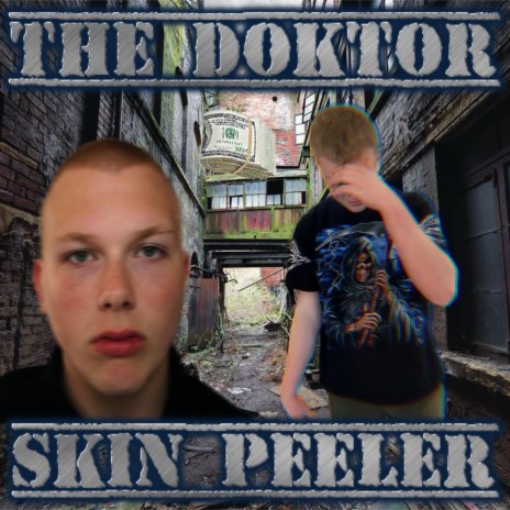 Skin Peeler