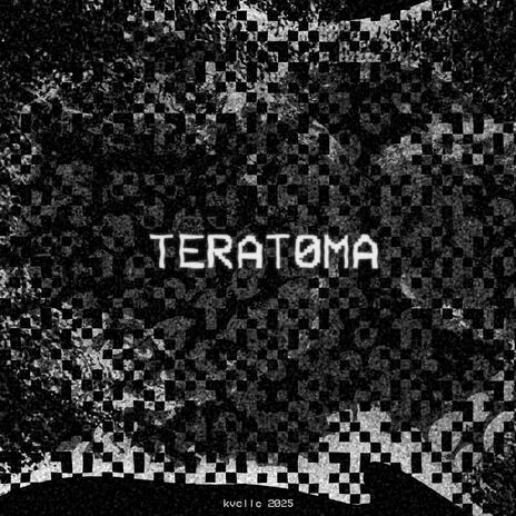 TERATOMA