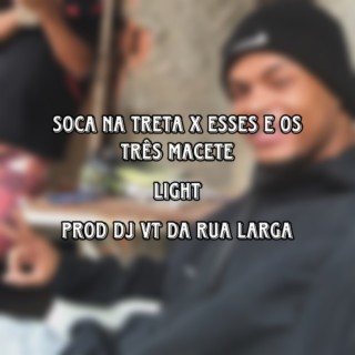 SOCA NA TRETA X ESSE E OS TRÊS MACETE LIGTH