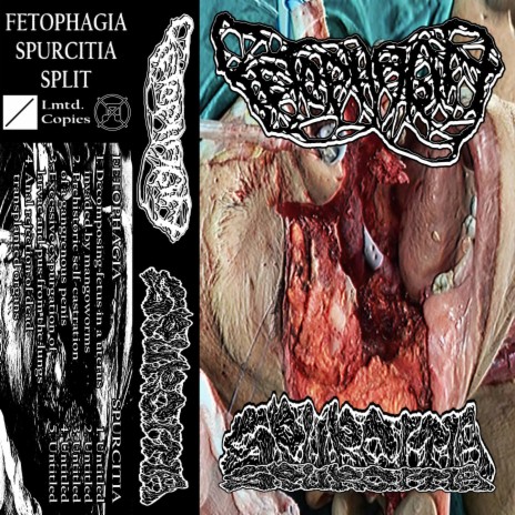 Excessive Expurgation of Larvae and Pus from the Lungs ft. Fetophagia