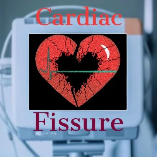 Cardiac Fissure