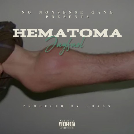 Hematoma | Boomplay Music