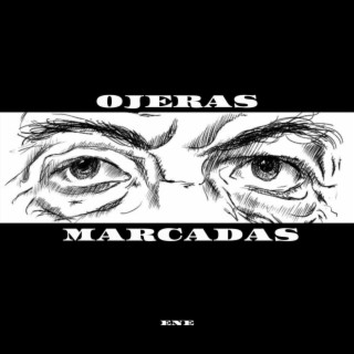 Ojeras Marcadas