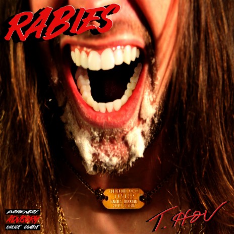 Rabies